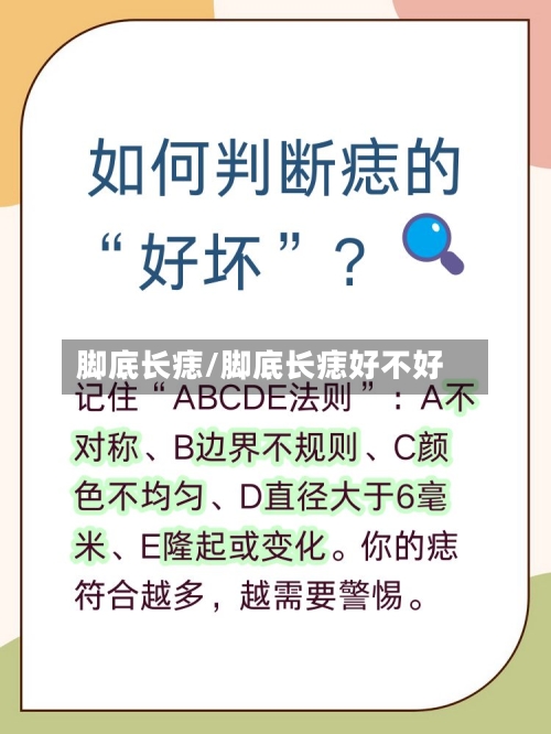 脚底长痣/脚底长痣好不好-第1张图片