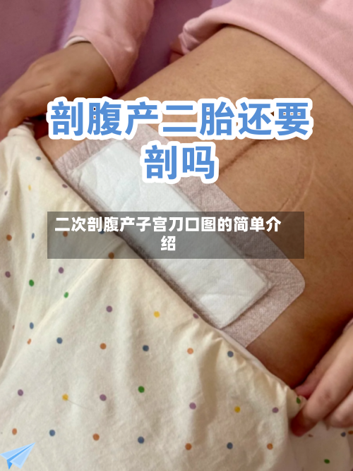 二次剖腹产子宫刀口图的简单介绍-第2张图片